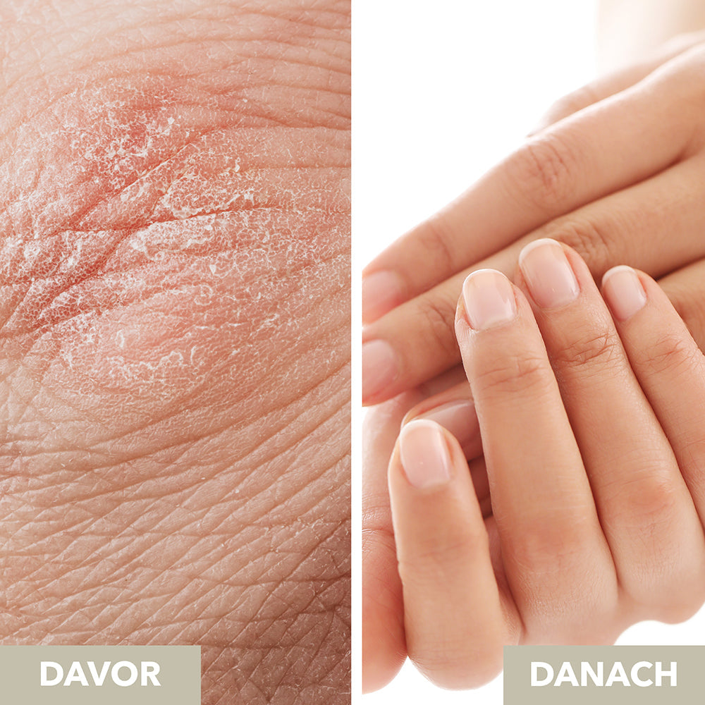 Handcreme | Hand Cream