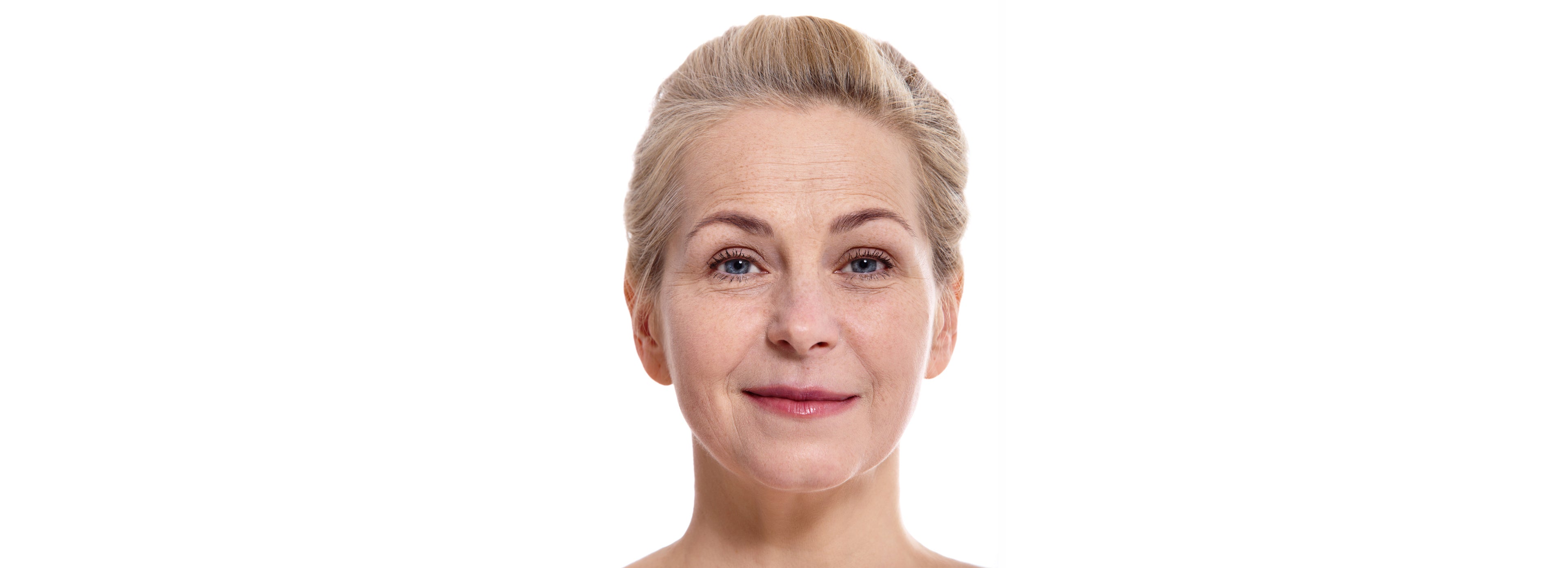 Falten & Feine Linien vor Anwendung von Anti-Aging Produkten