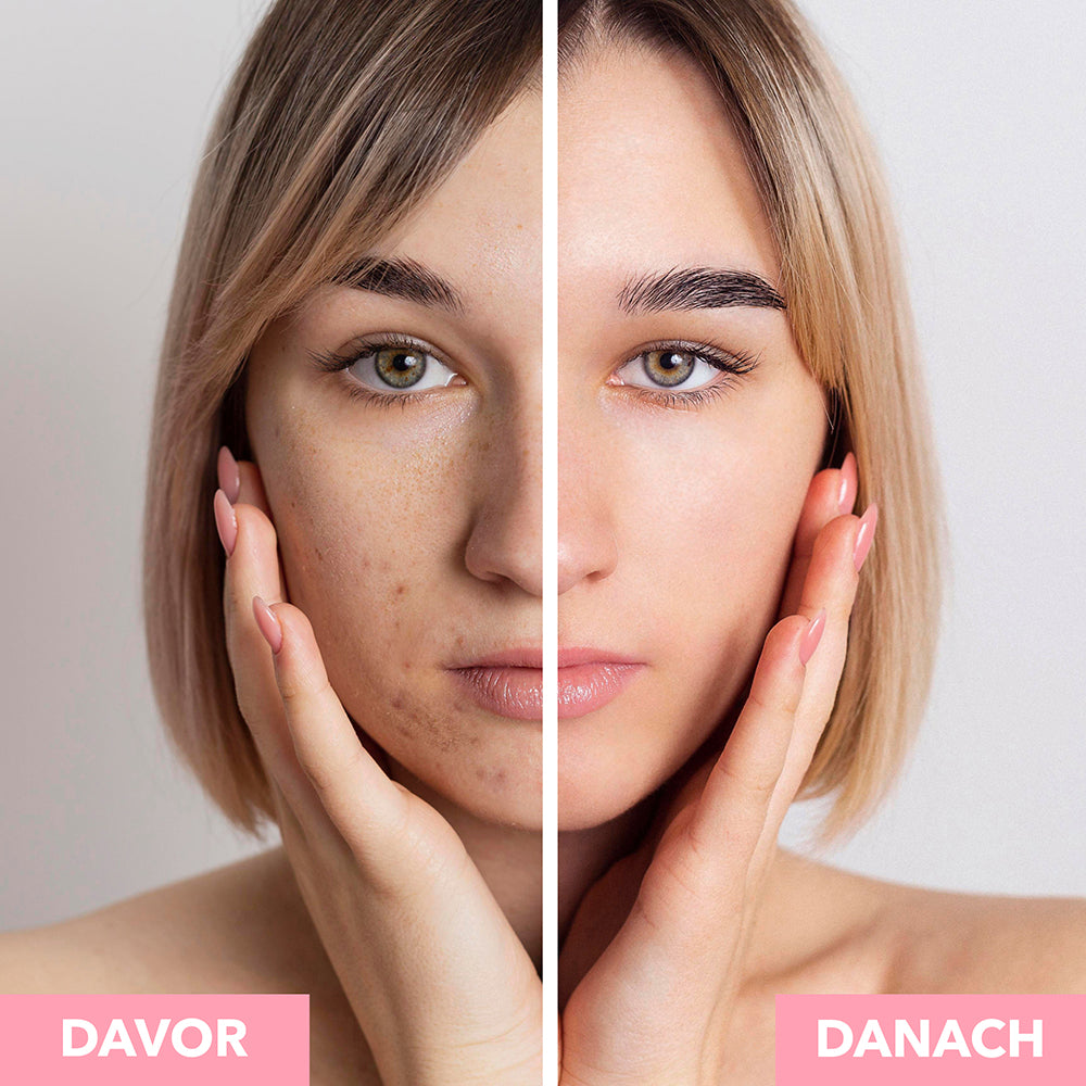 Reinigungsschaum / Gesichtsreinigung Vorher-Nachher-Effekt